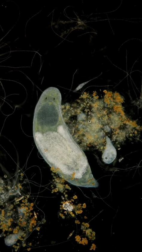  Free-Living Flatworm! An Intriguing Journey into the Microscopic World of Freshwater Predators