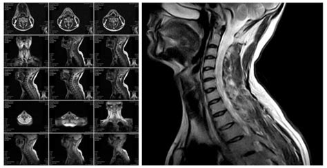 Does a CT Scan Show Nerve Damage: Exploring the Unseen Connections