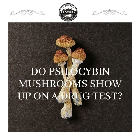 Does Mushrooms Show Up in a Drug Test: A Journey Through the Psychedelic and the Practical