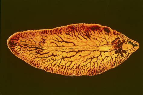  Fasciola hepatica: Parasitic Fluke With a Voracious Appetite for Liver Tissue!