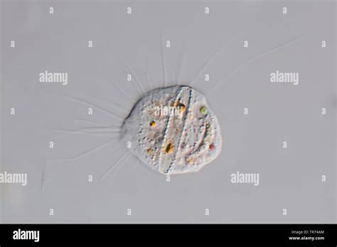  Xenoplasmodium - Miksi tämä Amoebozoa on kuin elävä mökki maaston alla?